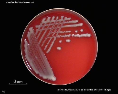 klebsiella on sheep blood agar